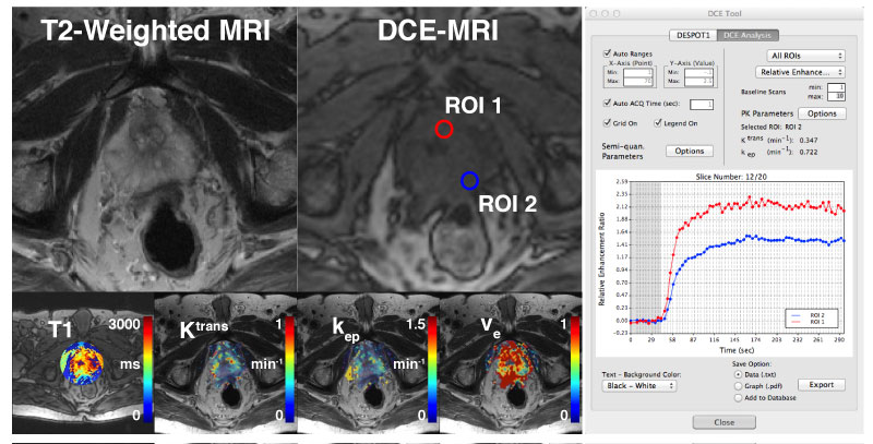 osirix lite length tool not working